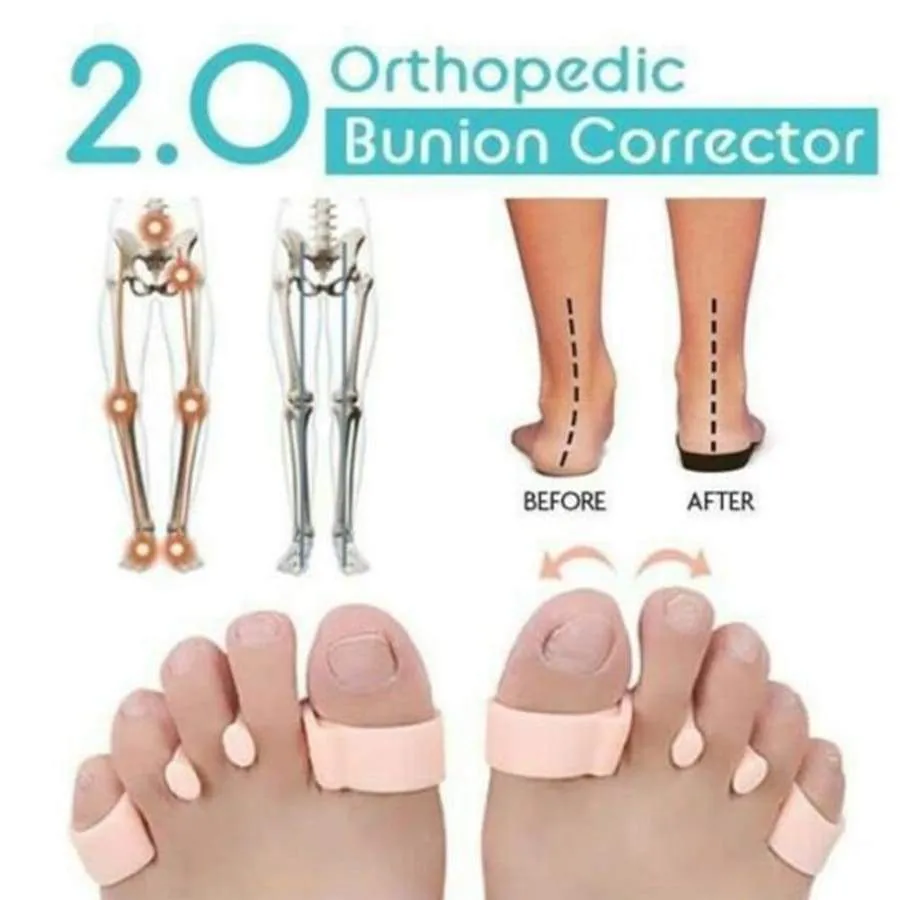 Orthopedic Bunion Corrector 2.0 (PAIR)